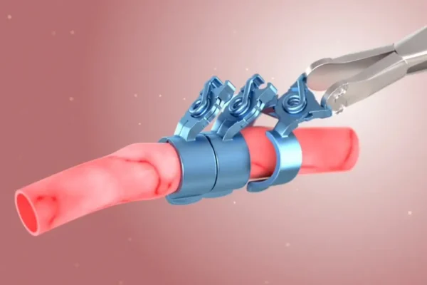 L-CLIP® - Image 5
